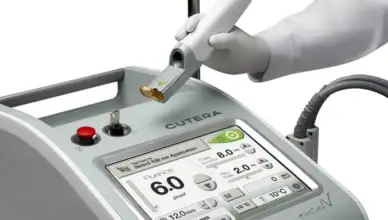 rozines-gydymas-lazeriu-belladerma-klinikoje-kaune