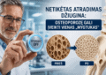 Netikėtas atradimas džiugina: osteoporozę gali įveikti vienas „mygtukas“