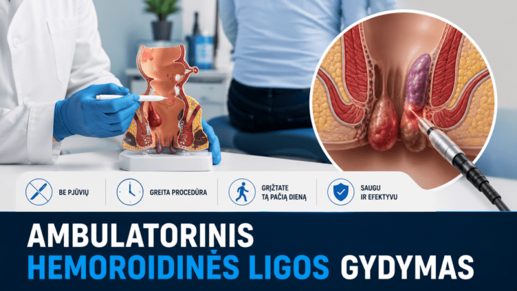 ambulatorinis-hemoroidines-ligos-gydymas